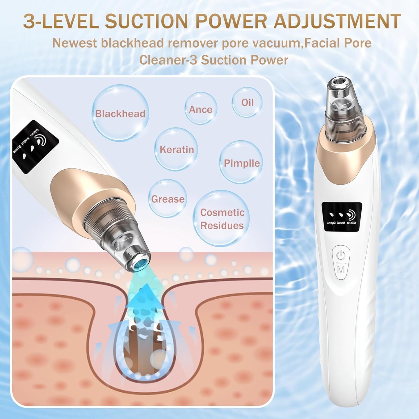 Blackhead Remover Vacuum – 3 Suction Levels, 5 Probes, USB Rechargeable - SmartPagesHub.com