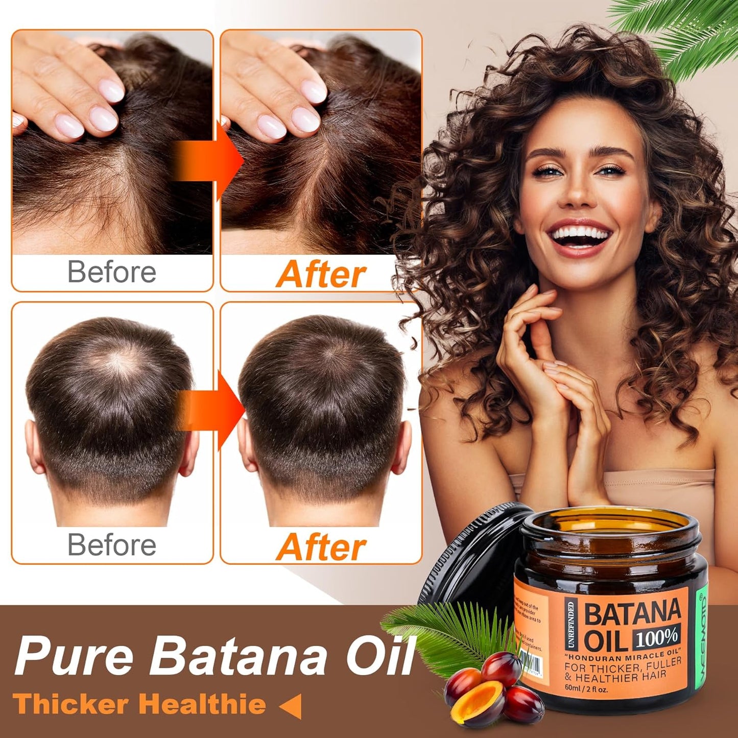 100% Raw Batana Oil – Hair Growth & Thickness Treatment - SmartPagesHub.com